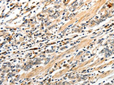 CD93 Antibody