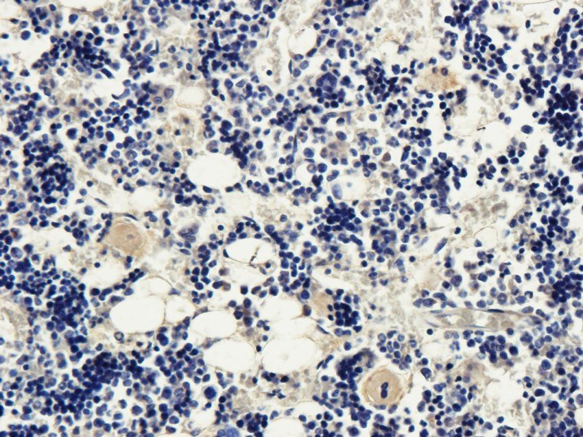 CD95 antibody