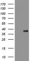 CD95 (FAS) antibody