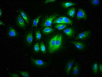 CD99L2 antibody