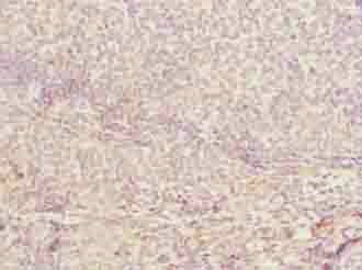 CDADC1 Antibody