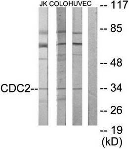 CDC2 antibody