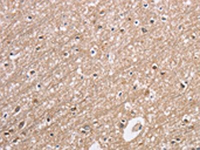 CDC34 Antibody