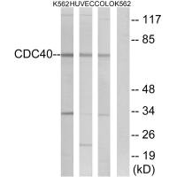 CDC40 antibody