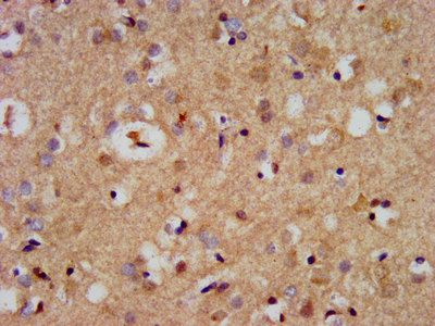 CDC42BPB Antibody