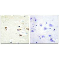 CDC42BPB Antibody
