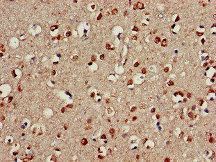CDC42EP3 Antibody