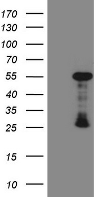 CDC6 antibody