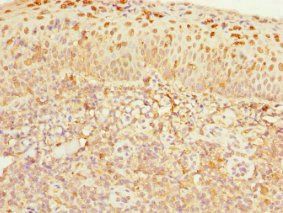 CDC7 Antibody