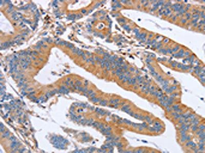 CDC7 Antibody