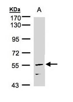 CDCA1 antibody