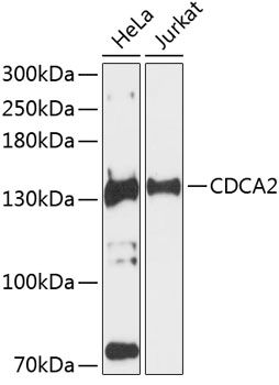 CDCA2 antibody