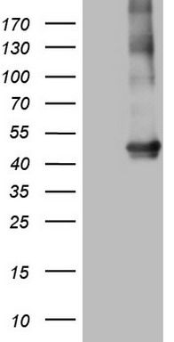 CDCA7L Antibody
