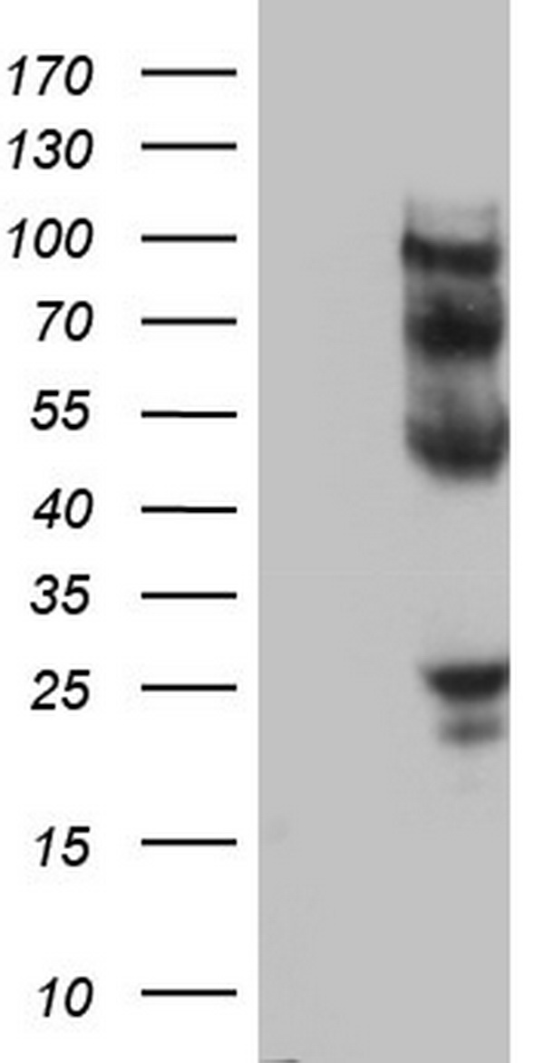CDCA7L antibody