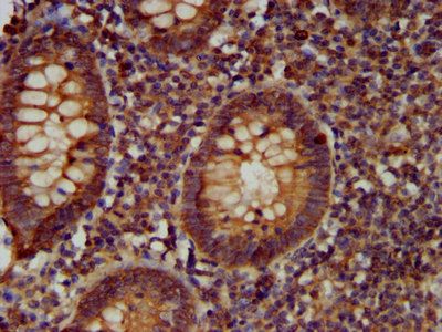 CDCA7L Antibody