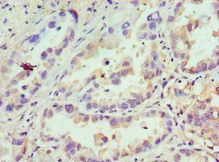 CDCA8 Antibody