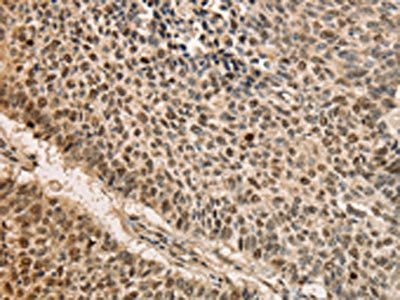 CDCA8 Antibody