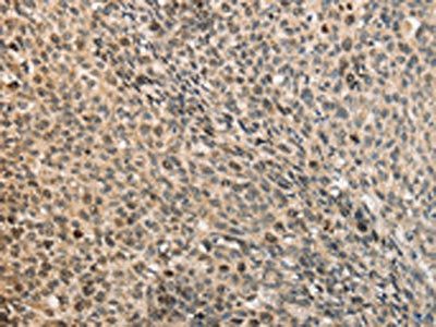 CDCA8 Antibody