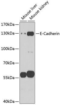 CDH1 antibody