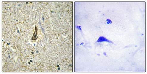 Cytochrome P450 26C1 Antibody