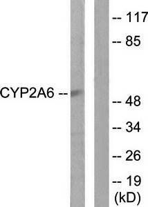 Cytochrome P450 2A6 Antibody