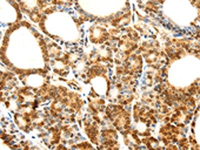 CDH23 Antibody