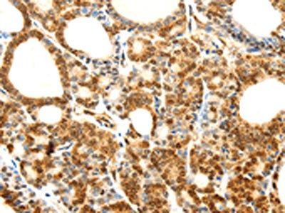 CDH23 antibody