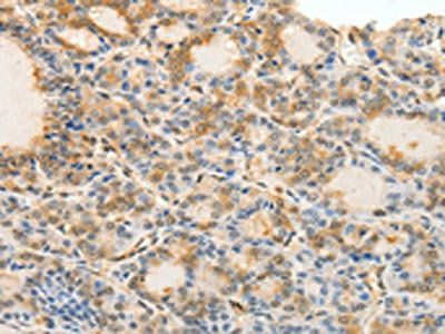 CDH23 Antibody