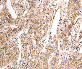 CDH23 antibody