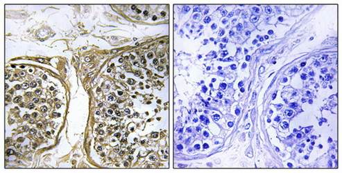 Cytochrome P450 2C8 Antibody