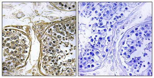 CDH26 antibody