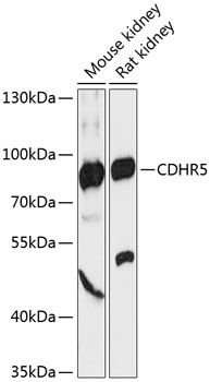 CDHR5 antibody
