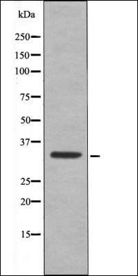 CDK1/CDC2 (Phospho-Thr161) antibody