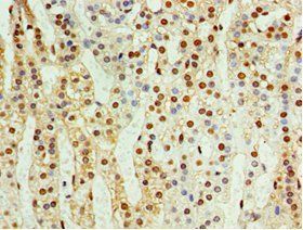 CDK10 antibody