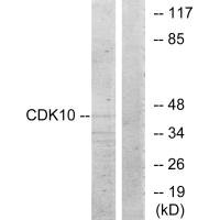 CDK10 antibody