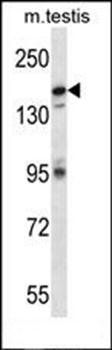 CDK13 antibody