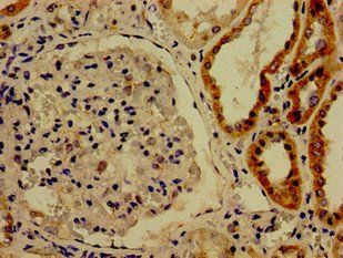 CDK13 Antibody