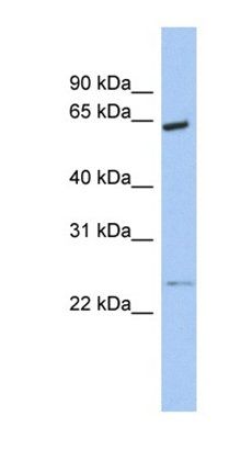 CDK16 antibody