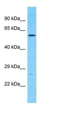 CDK17 antibody