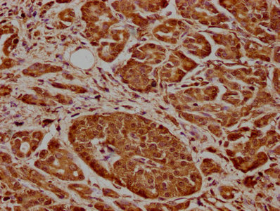 CDK17 antibody