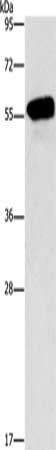 CDK19 antibody