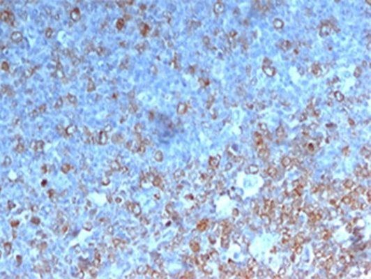 CDK1 Antibody