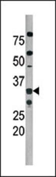 Cdk2 (phospho-Thr160) antibody