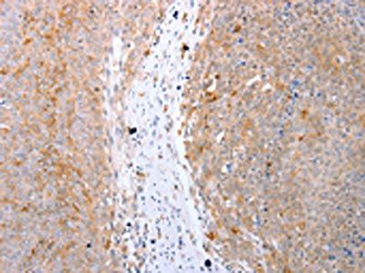 CDK20 Antibody