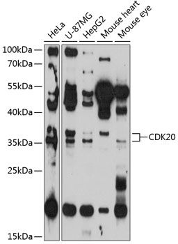 CDK20 antibody