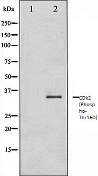 CDk2 (Phospho-Thr160) antibody