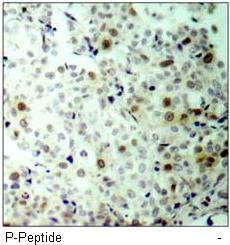 CDK2 (Phospho-Thr160) Antibody