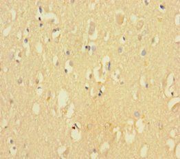 CDK2AP2 Antibody