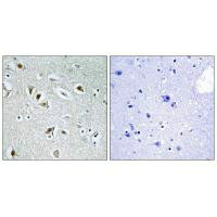 CDK2AP2 Antibody