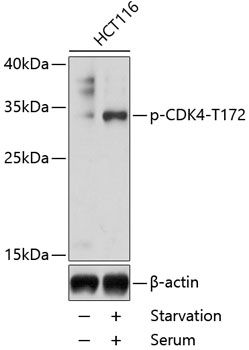 CDK4 (Phospho-T172) antibody